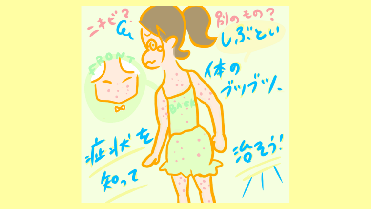 原因別の改善方法 長年悩んだ体のブツブツ 背中やお尻などのニキビ 毛包炎 毛孔性苔癬 うきうきよきよき